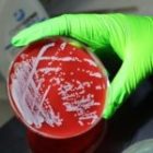 Genetic Breakthrough Reveals How Superbugs Outsmart Our Defenses